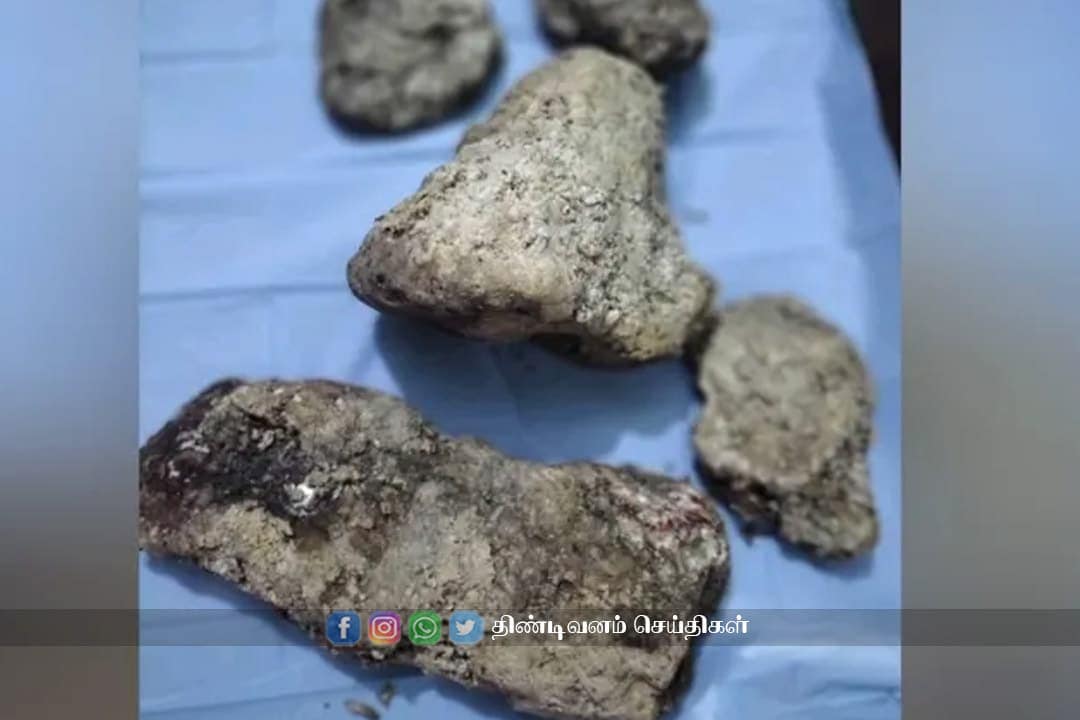 whale remains amber grease washed ashore in tantrayankuppam sea worth 3 5 crores